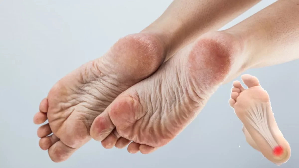 3 ingredience z lednice, které vrátí vašim patám hebkost jako v mládí! 11 Sherfashy patám